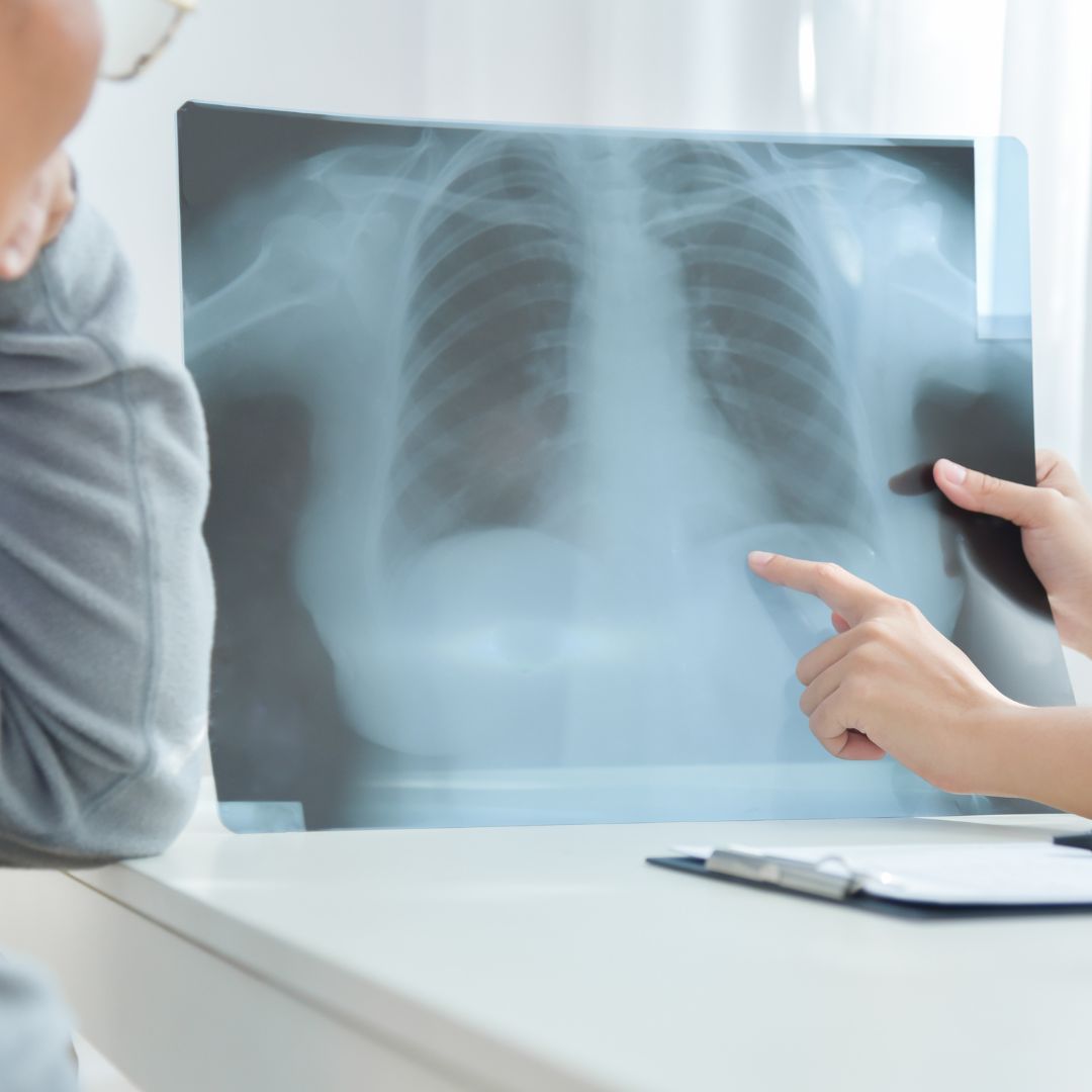 Person showing xray of lungs to patient